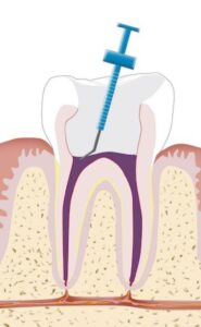 Endodontie