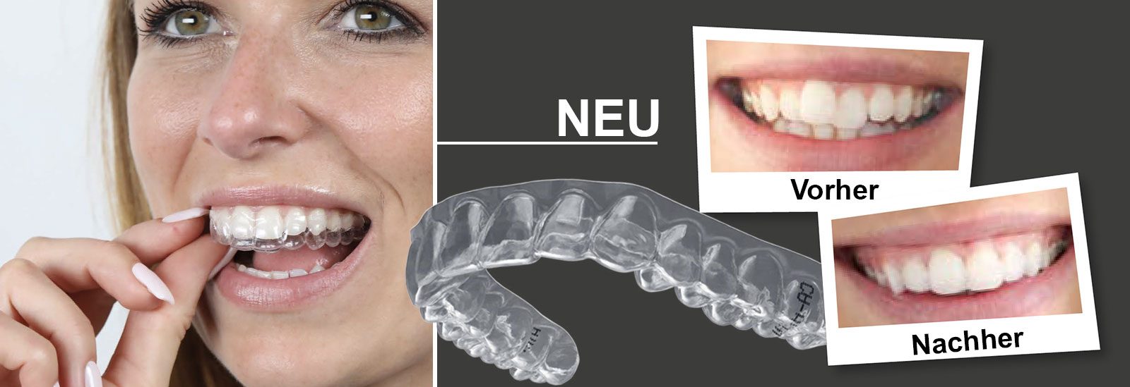 ÄSTHETISCHE ZAHNKORREKTUR